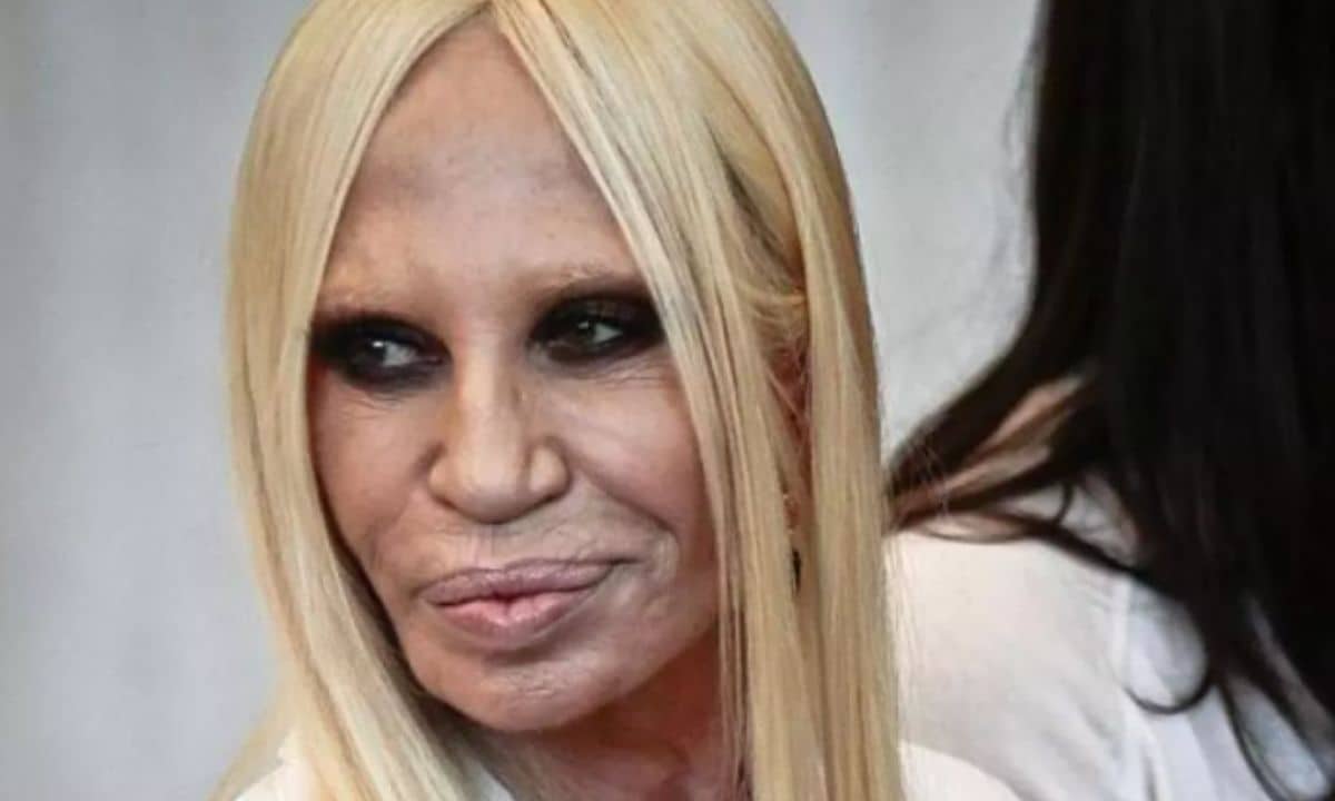 Donatella Versace prima dopo chirurgia