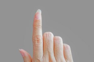 Problemi alle unghie: i segnali da non sottovalutare